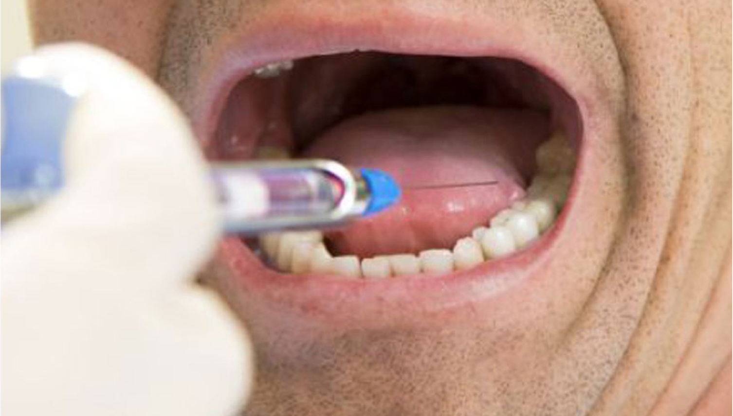 Ex-Zuger Zahnarzt hat nun auch im Kanton Zürich Berufsverbot