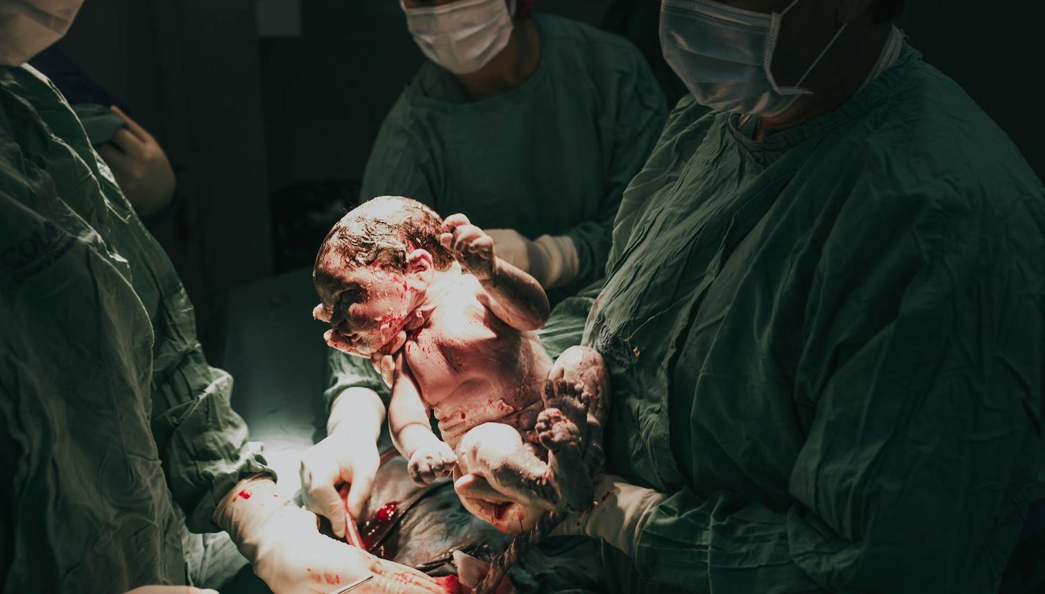 Realität Kaiserschnitt: So eine Angst hatte ich noch nie