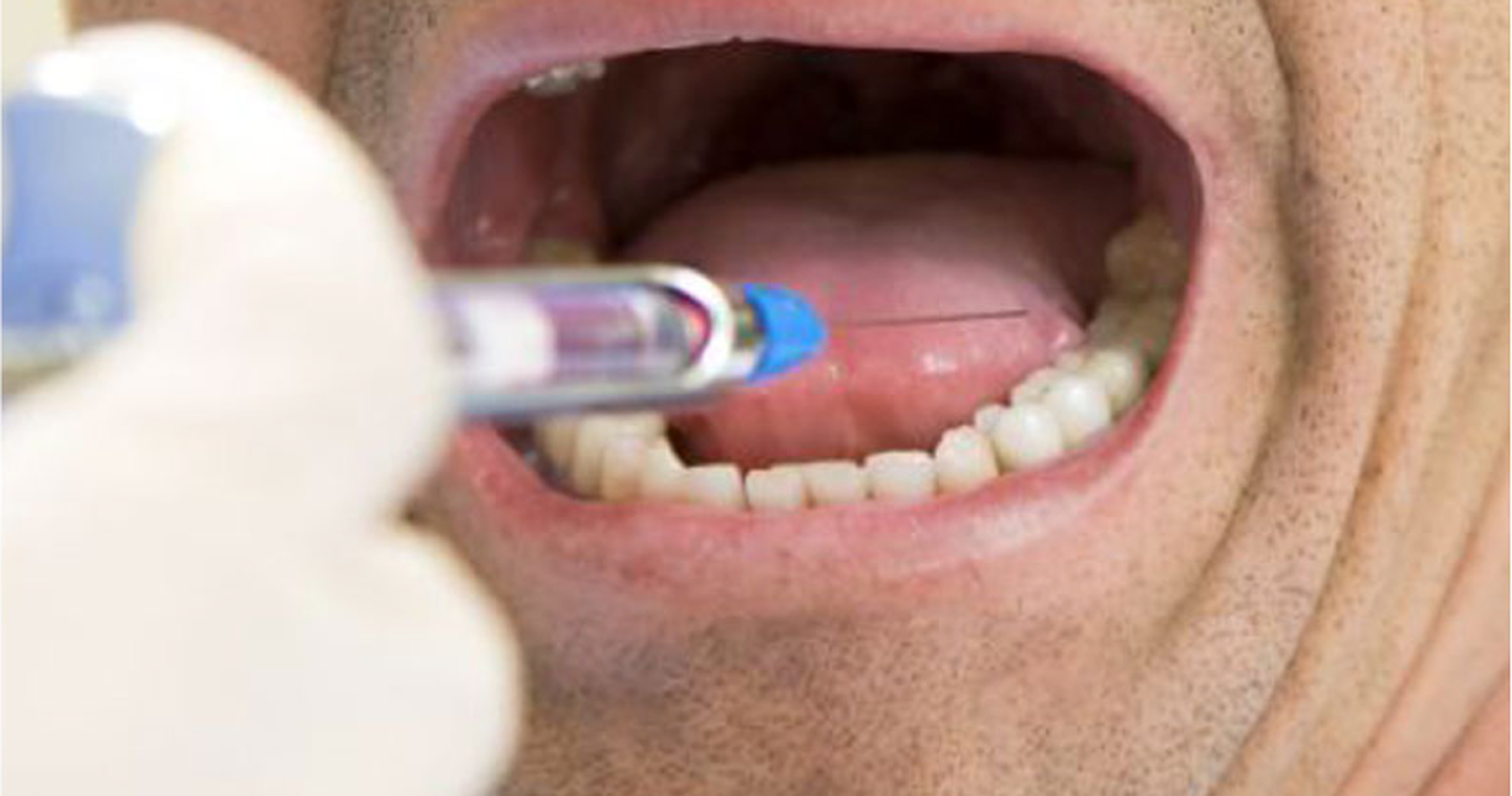Ex-Zuger Zahnarzt hat nun auch im Kanton Zürich Berufsverbot